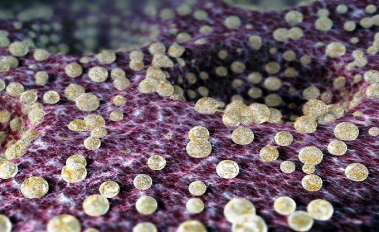 579e2d16c46188d8218b45ac