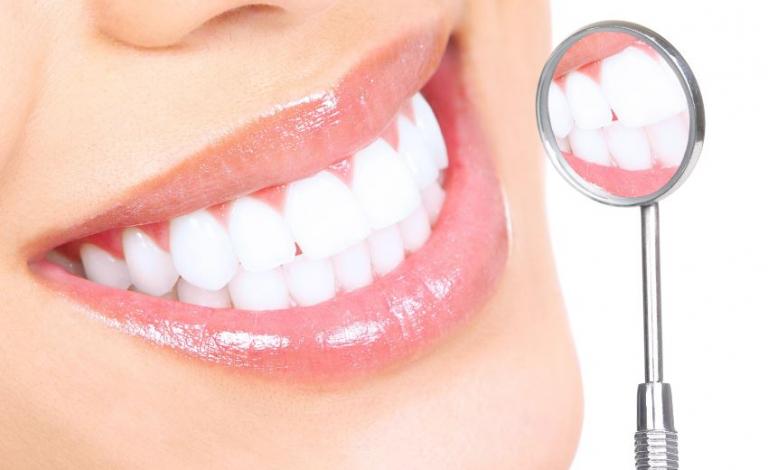 تبيض الأسنان