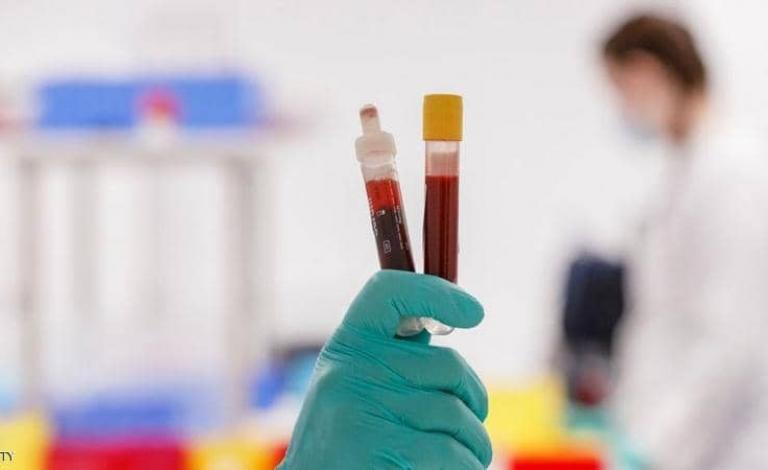 فحوص الأجسام المضادة