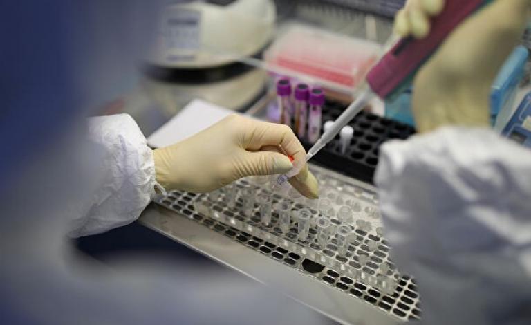 اختبار اللعاب بديل مسحة الكشف عن كورونا