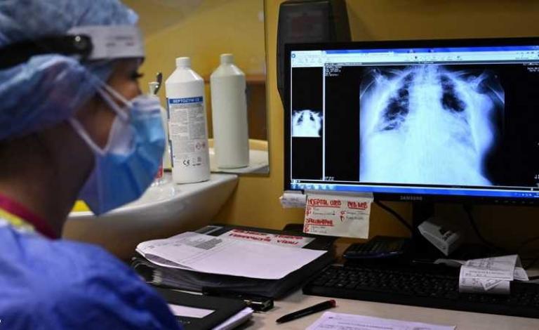 اكتشاف عارض خطير لدى المصابين بكوفيد.. تضرر عضو حيوي