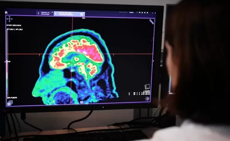 صورة دماغ بشري