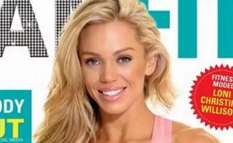 عارضة الأزياء السابقة، لوني ويليسون