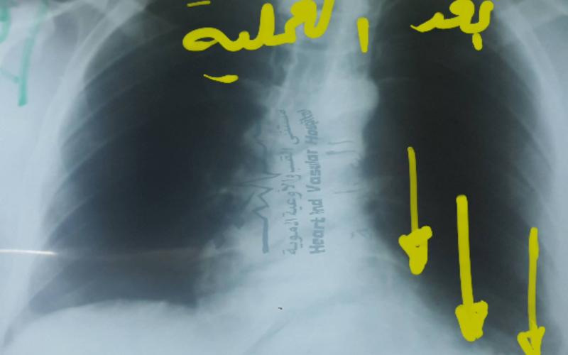 13010257_1533320486969842_35369496_o