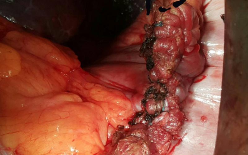 12986580_1533320470303177_1280184213_o