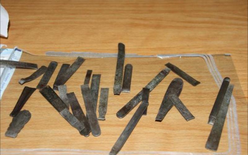 استخراج عشرات الملاعق والبراغي من بطن فلسطيني