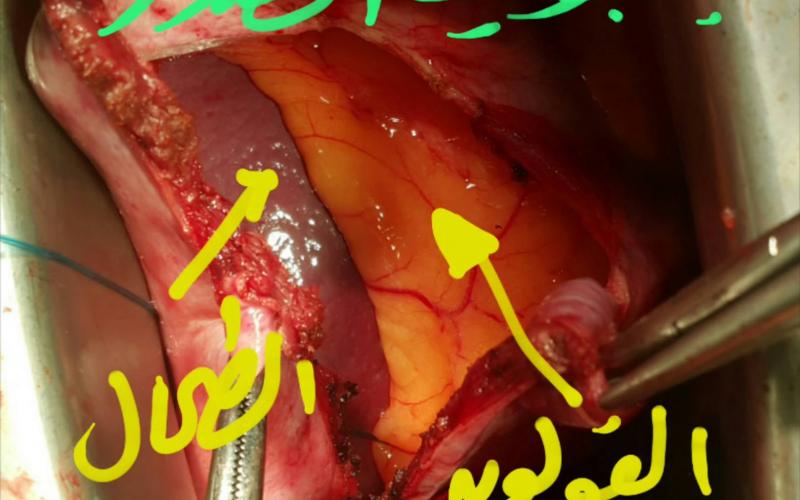 12986356_1533320443636513_1799588941_o