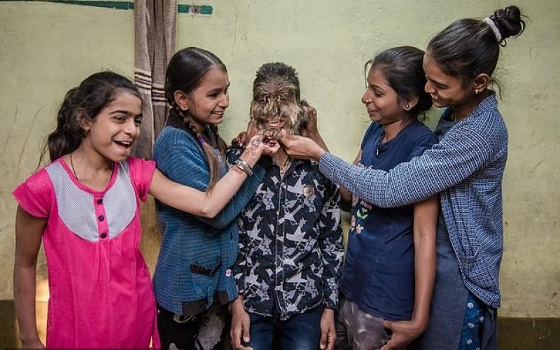 ما قصة "الطفل الذئب" في الهند؟