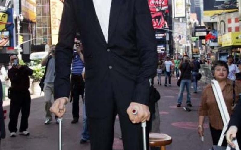 بالصور..أطول رجل في العالم تركي يواصل النمو