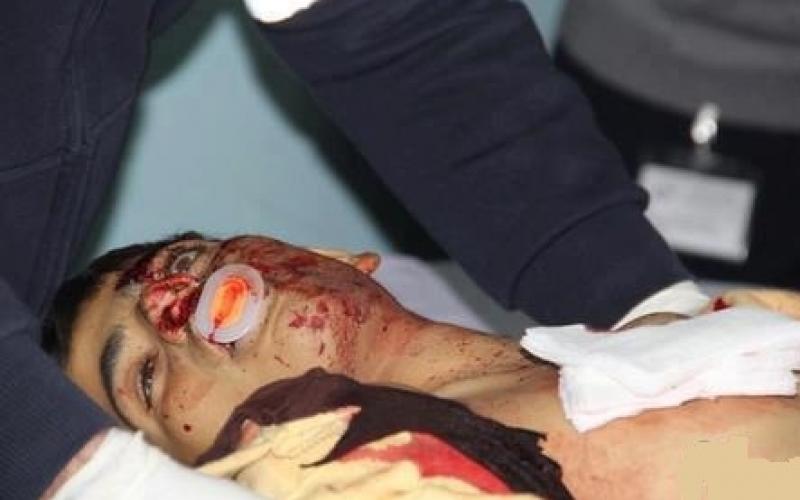 بالصور ..الشهيد الطفل سمير عوض