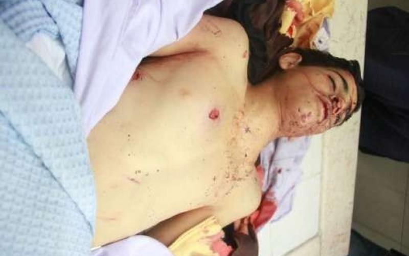 الاحتلال يقتل شابا في رام الله (صور)