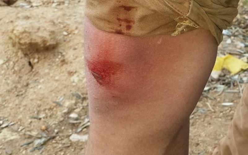 صور: إصابة شاب في مواجهات بدير نظام