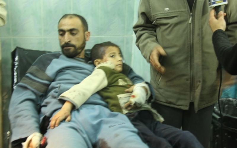 بالصور .. اصابات في قصف على المدنيين