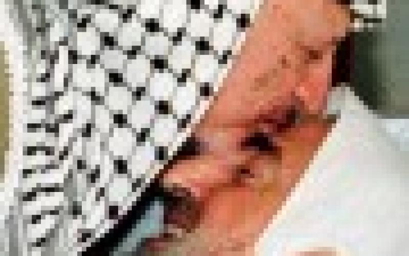 صور: مجموعة صور نادرة للشيخ "ياسين"