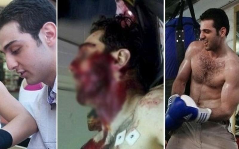 منفذ تفجير بوسطن وهو قتيل (صورة)