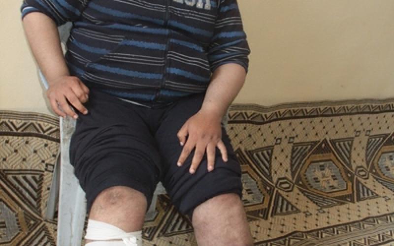 بالصور: عندما يجتمع الفقر والمرض معاً