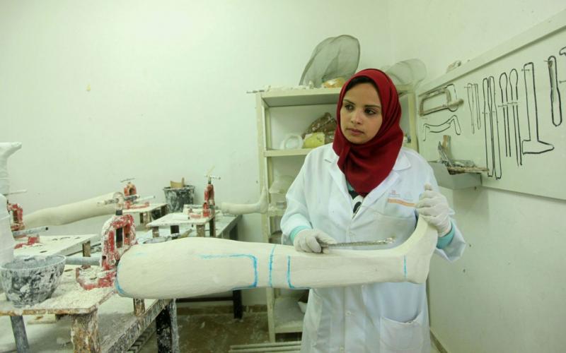 صور: أول فتاة تصنع الأطراف الصناعية بغزة