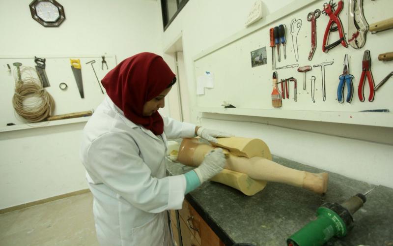 صور: أول فتاة تصنع الأطراف الصناعية بغزة
