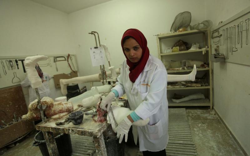 صور: أول فتاة تصنع الأطراف الصناعية بغزة