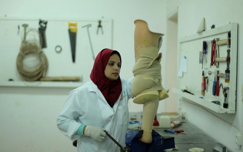صور: أول فتاة تصنع الأطراف الصناعية بغزة