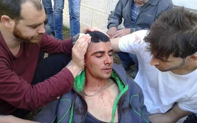 صور: مواجهات بمسيرة عوفر والمعصرة