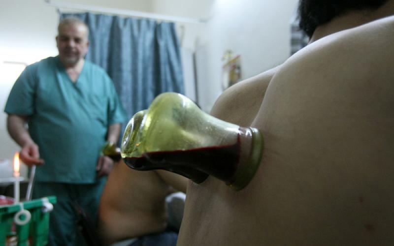 صور: الحجامة التقليدية في الخليل