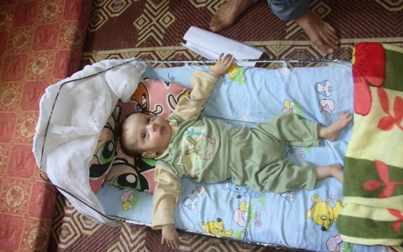 بالصور.. "عائلة علوان".. فقرٌ مدقعٌ ومَرضٌ مفزعٌ
