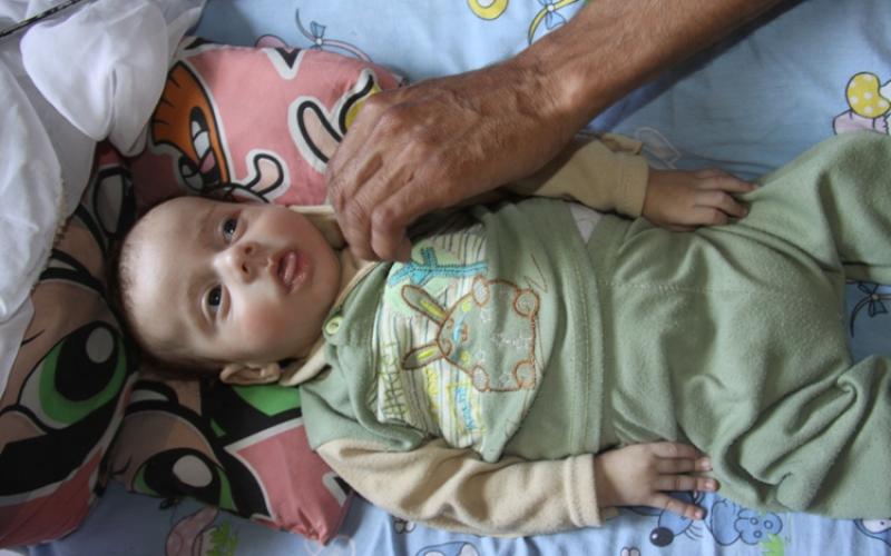 بالصور.. "عائلة علوان".. فقرٌ مدقعٌ ومَرضٌ مفزعٌ