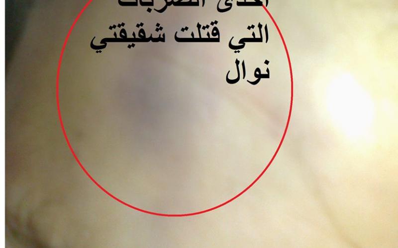 صور: المغدورة "قديح" وجنينها اللذين قتلتهما الحماة