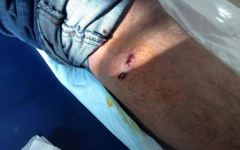 بالصور:إصابة 7 فلسطينيين وإسرائيليين في سلواد