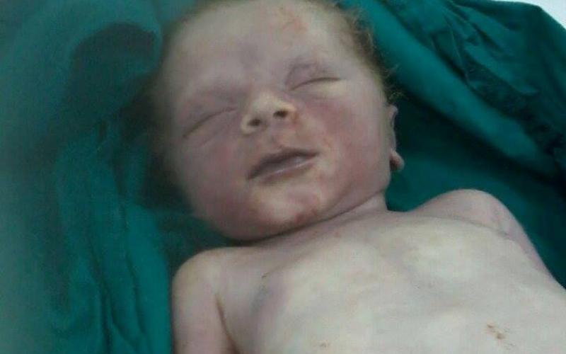 بالصور: الإهمال الطبي يودي بحياة جنين في غزة