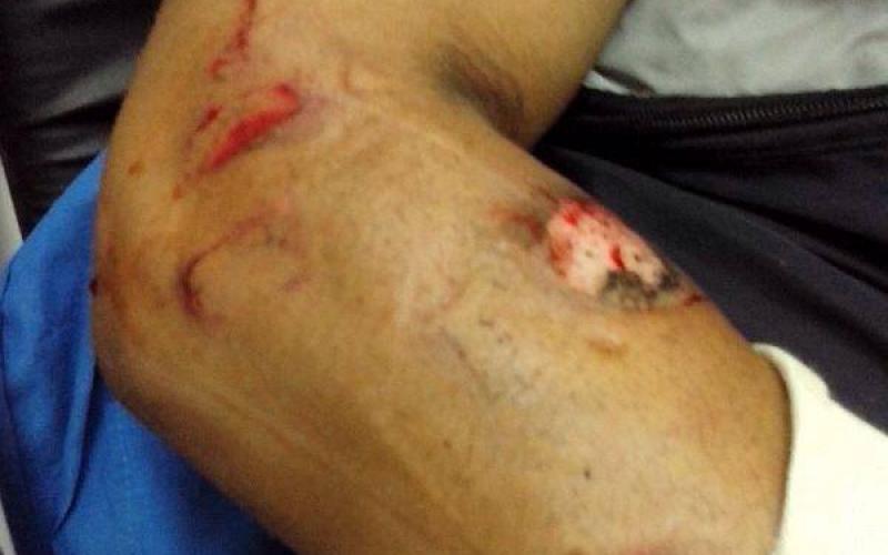بالصور: العيسوية تخضع لحصار منذ 5 أيام