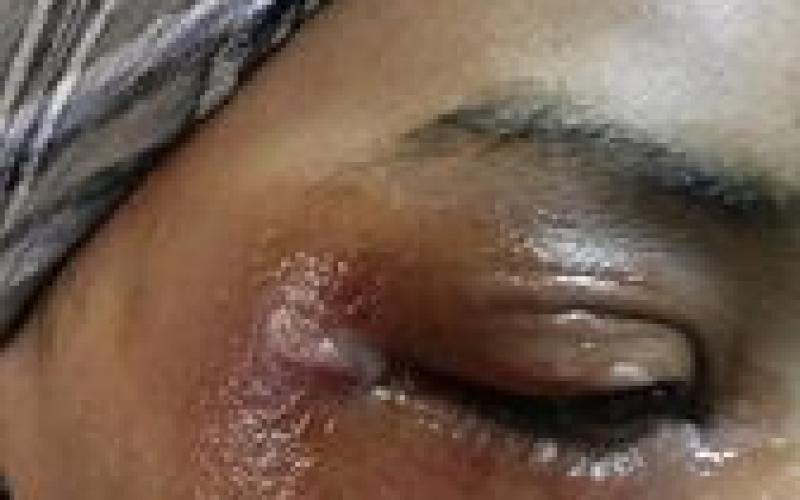 صور: اعتداء الاحتلال على الصحفية سراحنة