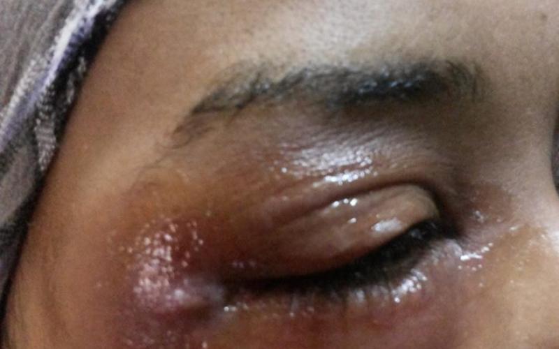 صور: اعتداء الاحتلال على الصحفية سراحنة