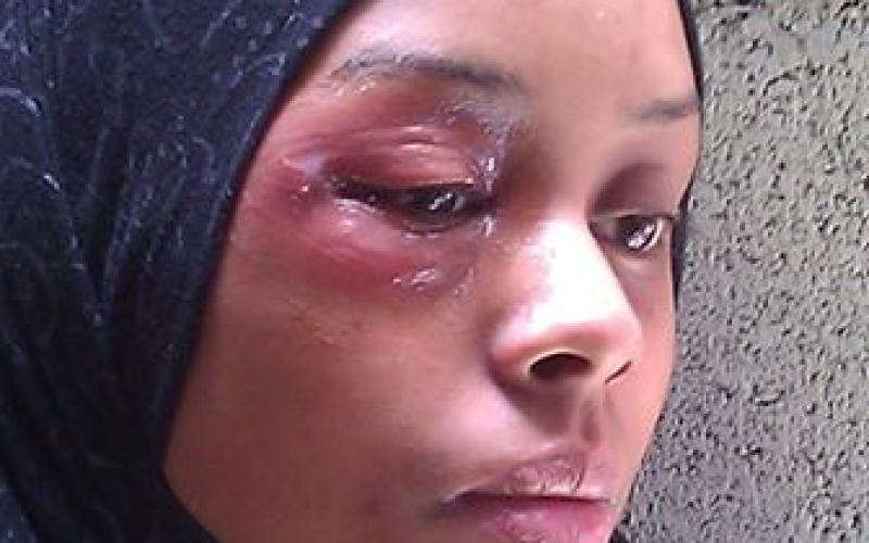 صور: اعتداء الاحتلال على الصحفية سراحنة