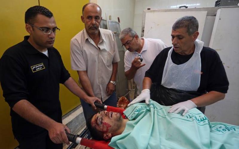 صور: الشهيد "غنايم" برام الله