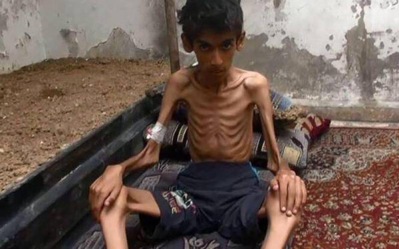 صور: الموت جوعاً في أرياف دمشق