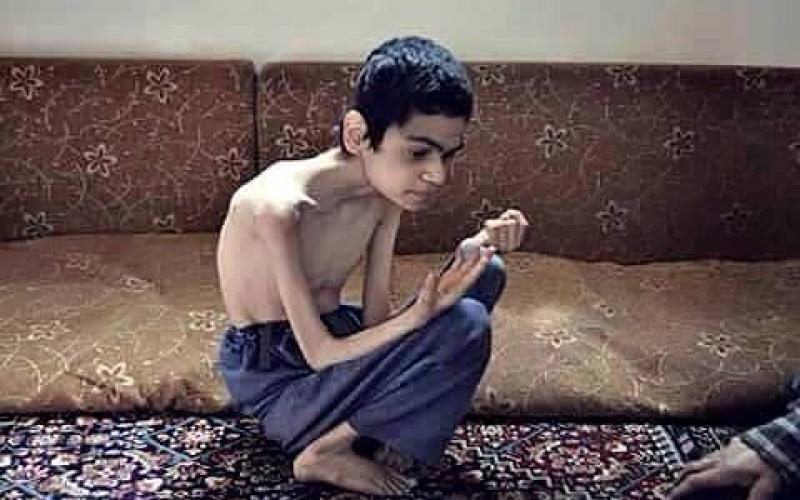 صور: الموت جوعاً في أرياف دمشق