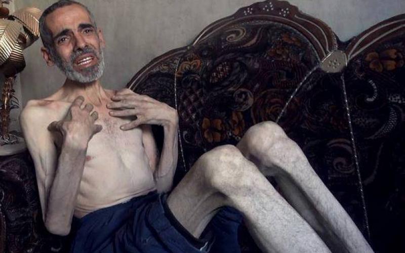 صور: الموت جوعاً في أرياف دمشق
