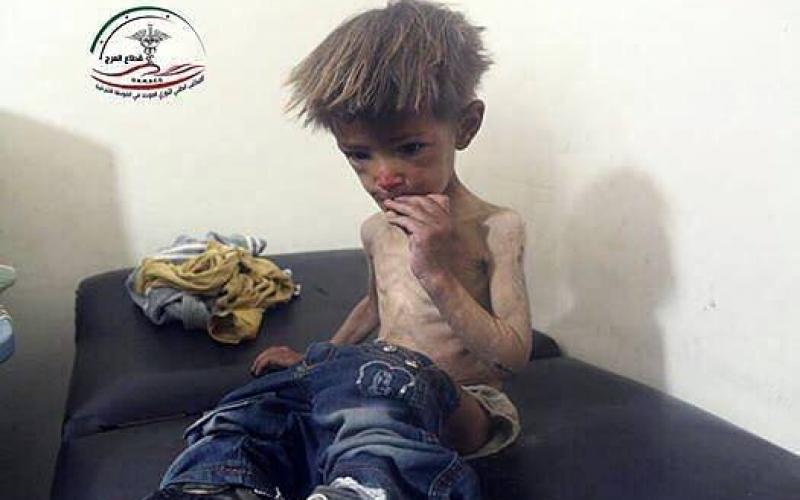 صور: الموت جوعاً في أرياف دمشق