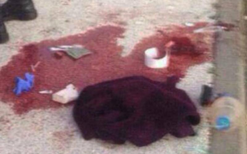 بالصور: إصابة فلسطيني طعن جنديا إسرائيليا بالقدس