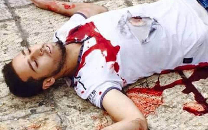 بالصور: إصابة فلسطيني طعن جنديا إسرائيليا بالقدس
