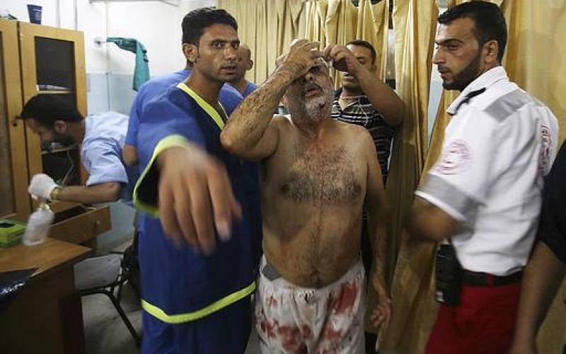 صور: بعض جرحى العدوان المتواصل على غزة