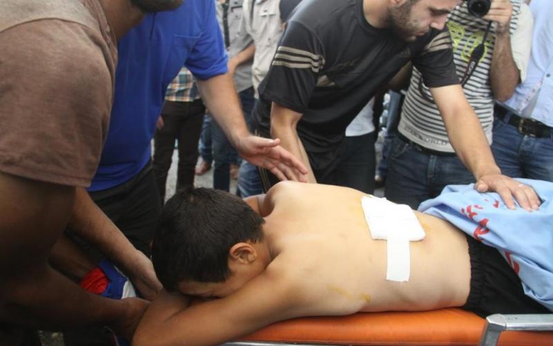 صور: إصابات من الأطفال بغارات الاحتلال على غزة