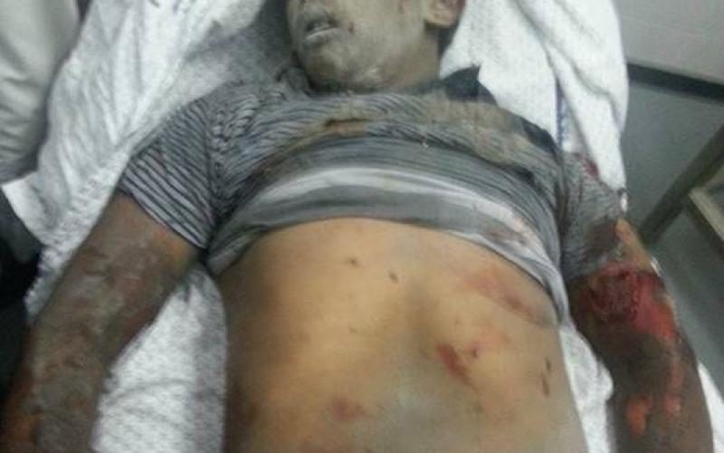 بالصور: 7 شهداء باستهداف منزل عائلة كوارع (تحذير +18)