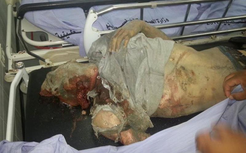 بالصور: 7 شهداء باستهداف منزل عائلة كوارع (تحذير +18)