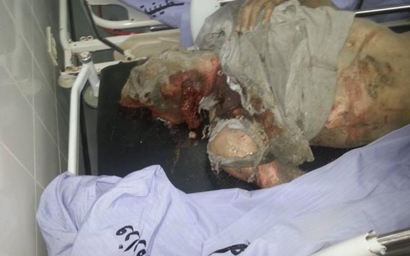 بالصور: 7 شهداء باستهداف منزل عائلة كوارع (تحذير +18)