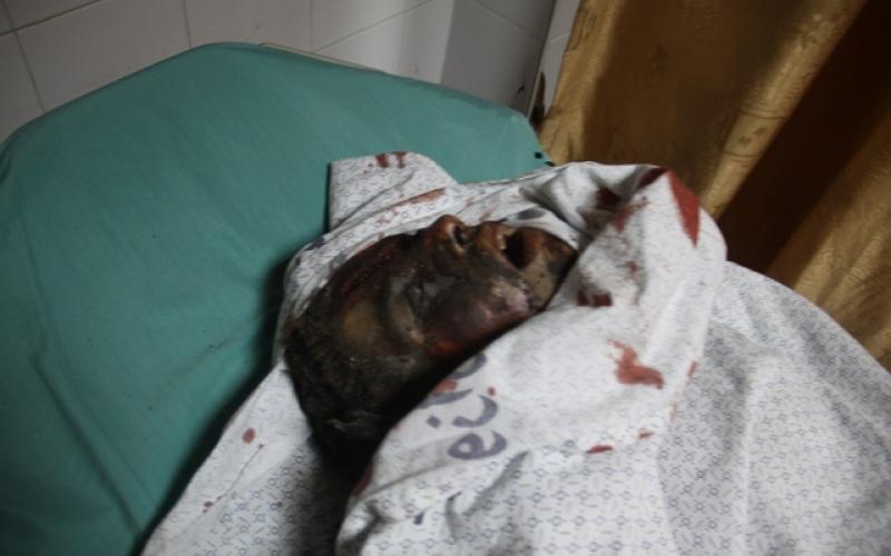 صور: شهداء وجرحى باستهداف منزل عائلة "كوارع"