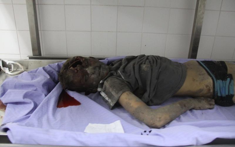 صور: شهداء وجرحى باستهداف منزل عائلة "كوارع"