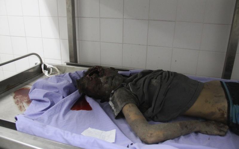 صور: شهداء وجرحى باستهداف منزل عائلة "كوارع"